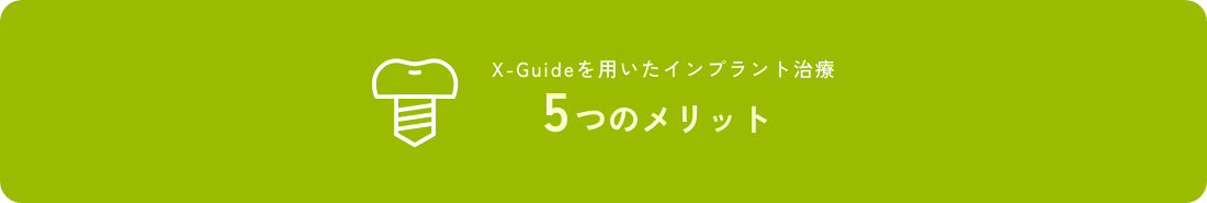 X-Guideを用いたインプラント治療5つのメリット